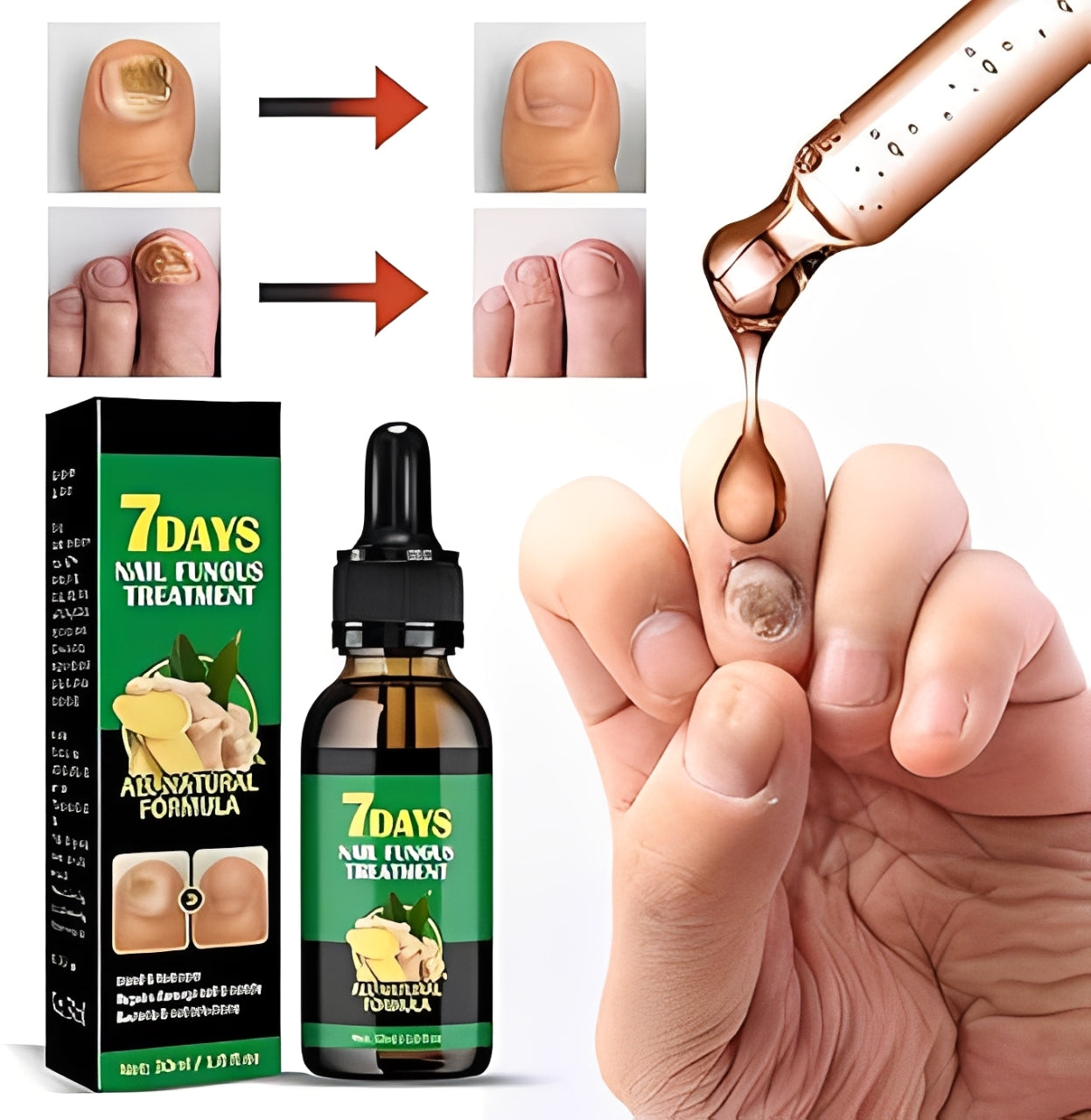 Fungixil® Original - elimina y previene el hongo de tus uñas