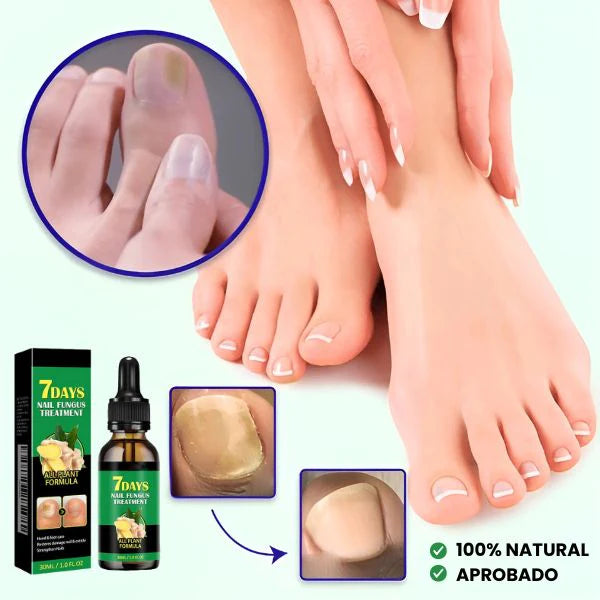 Fungixil® Original - elimina y previene el hongo de tus uñas
