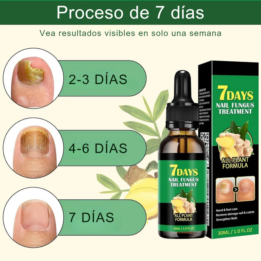Fungixil® Original - elimina y previene el hongo de tus uñas