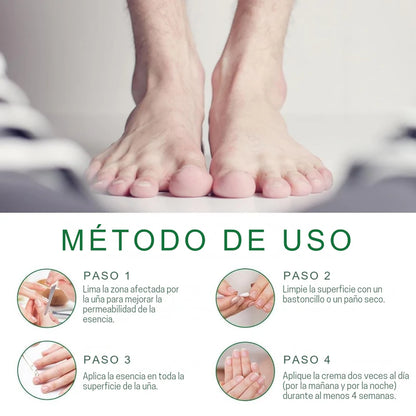 Fungixil® Original - elimina y previene el hongo de tus uñas